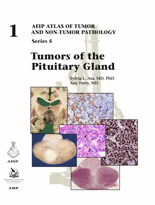 Tumors of the Pituitary Gland（AFIP Atlas of Tumor & Non-Tumor Pathology, 5th Series,Fascicle 1）
