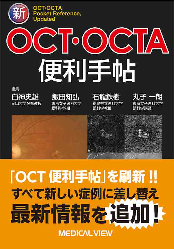 OCTとOCTAが,わかる!役立つ!  新編眼科プラクティス