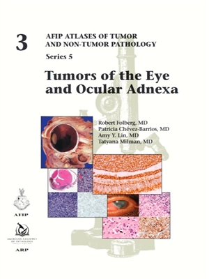Tumors of Eye & Ocular Adnexa（AFIP Atlas of Tumor & Non-Tumor Pathology, 5th Series,Fascicle 3）