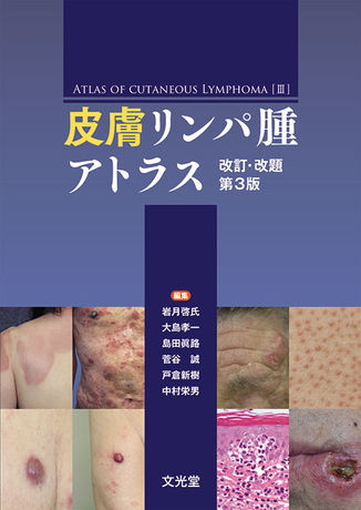 皮膚リンパ腫アトラス改訂・改題第3版