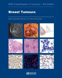 Breast Tumours （WHO Classification of Tumours, 5th Edition, Volume 2）
