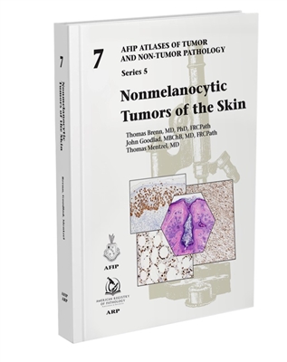 Nonmelanocytic Tumors of the Skin（AFIP Atlas of Tumor & Non-Tumor Pathology, 5th Series,Fascicle 7）
