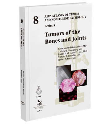 Tumors of the Bones and Joints （AFIP Atlas of Tumor & Non-Tumor Pathology, 5th Series,Fascicle 8）