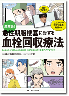 《電子書籍.m3.com》超解説！ 急性期脳梗塞に対する血栓回収療法 Lesion cross，combined techniqueから頭蓋内ステントまで