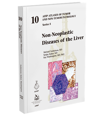 Non-Neoplastic Diseases of Liver（AFIP Atlas of Tumor & Non-Tumor Pathology, 5th Series,Fascicle 10）
