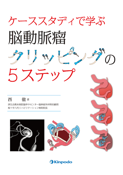 《電子書籍.m3.com》ケーススタディで学ぶ　脳動脈瘤クリッピングの5ステップ