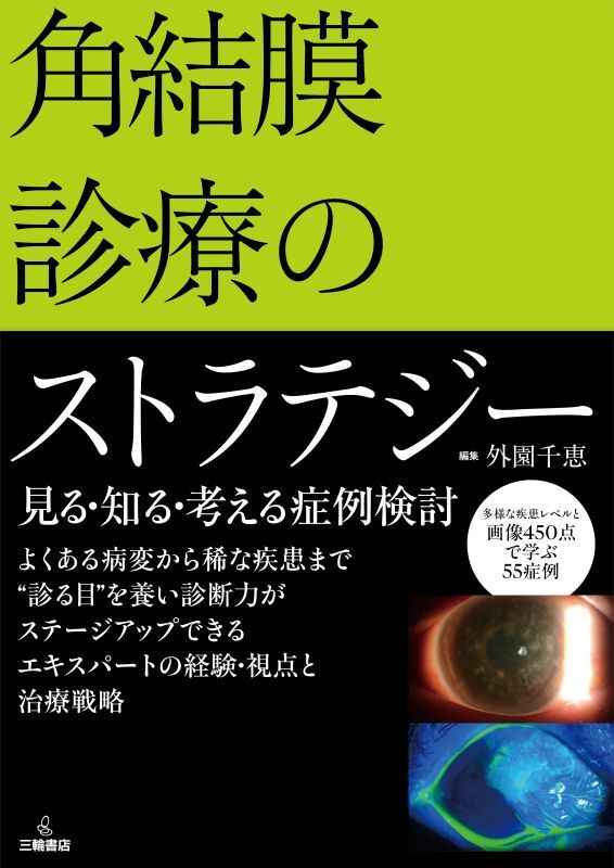 角膜疾患外来でこう診てこう治せ　裁断なし