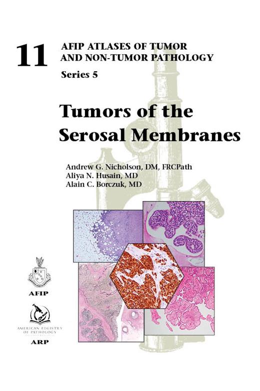 Tumors of the Serosal Membrane（AFIP Atlas of Tumor & Non-Tumor Pathology, 5th Series,Fascicle 11）