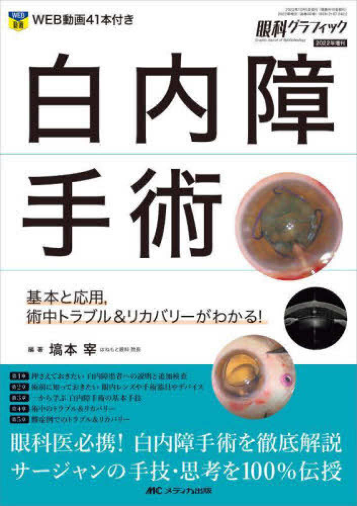 白内障手術 [眼科グラフィック2022年増刊] - メディカルブックサービス