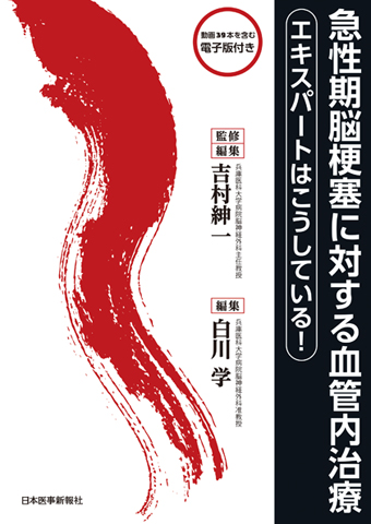 《電子書籍.m3.com》急性期脳梗塞に対する血管内治療 エキスパートはこうしている！