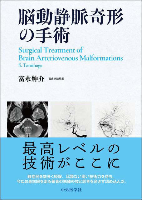 《電子書籍.m3.com》脳動静脈奇形の手術