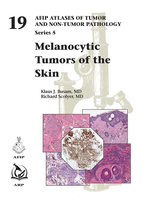 Melanocytic Tumors of the Skin (AFIP Atlas of Tumor & Non-Tumor Pathology, 5th Series,Fascicle 19)