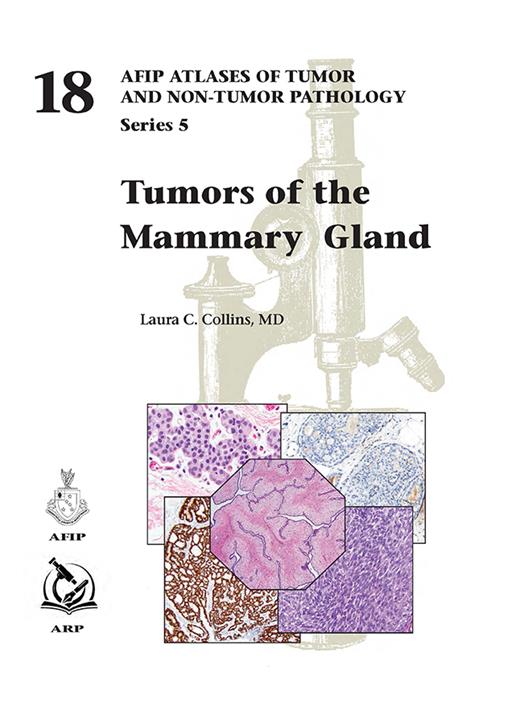 Tumors of the Mammary Gland（AFIP Atlas of Tumor & Non-Tumor Pathology, 5th Series,Fascicle 18）