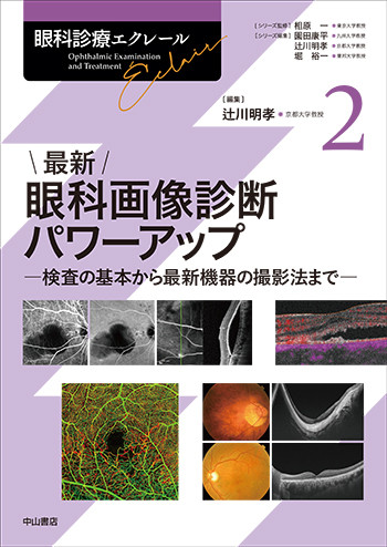 最新 眼科画像診断パワーアップ－検査の基本から最新機器の撮影法まで（眼科診療エクレール 2）