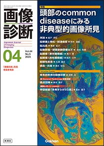 【画像診断 2024年04月号】頭部のcommon diseaseにみる非典型的画像所見