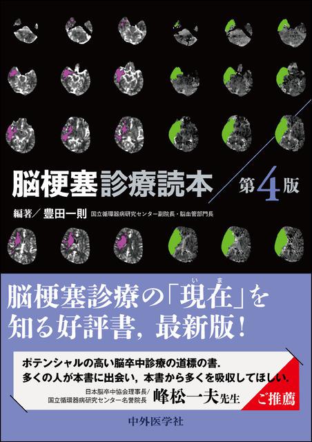 《電子書籍.m3.com》脳梗塞診療読本 第4版