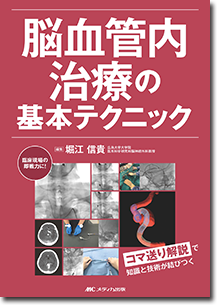 《電子書籍.m3.com》脳血管内治療の基本テクニック