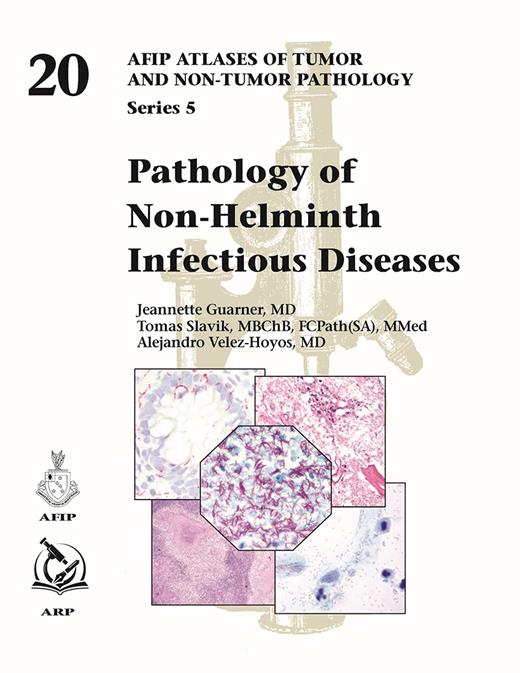 Pathology of Non-Helminth Infectious Diseases (AFIP Atlas of Tumor & Non-Tumor Pathology, 5th Series,Fascicle 20)