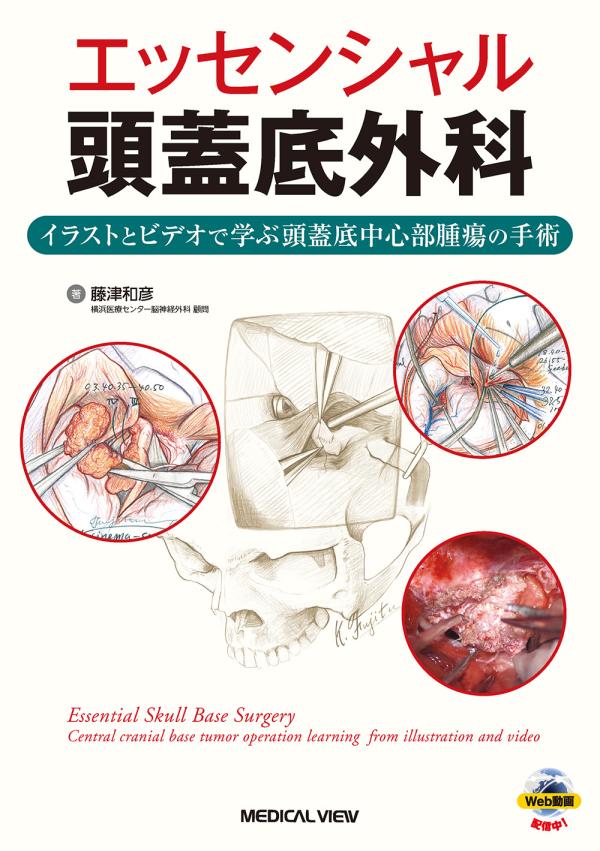 《電子書籍.m3.com》エッセンシャル頭蓋底外科 ［Web動画付］ イラストとビデオで学ぶ頭蓋底中心部腫瘍の手術