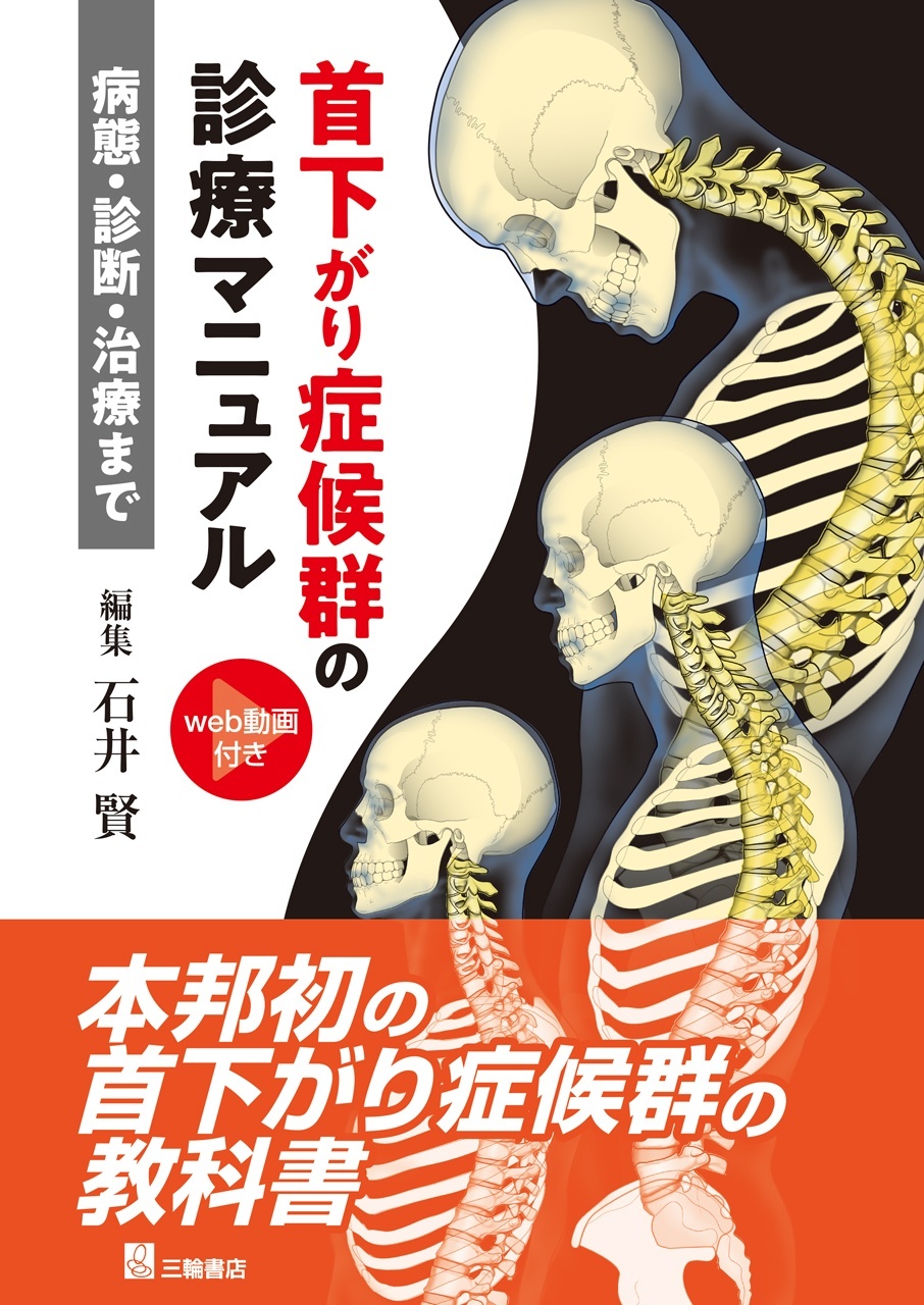 首下がり症候群の診療マニュアルー病態・診断・治療まで